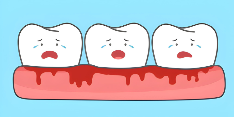 Emergency Dental Care for Bleeding Gums and Oral Injuries